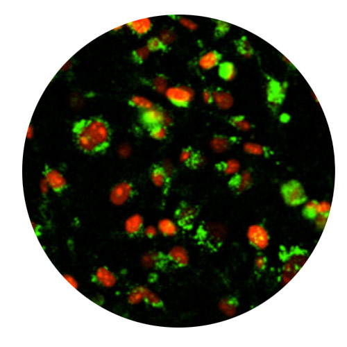 Immunocytochemistry