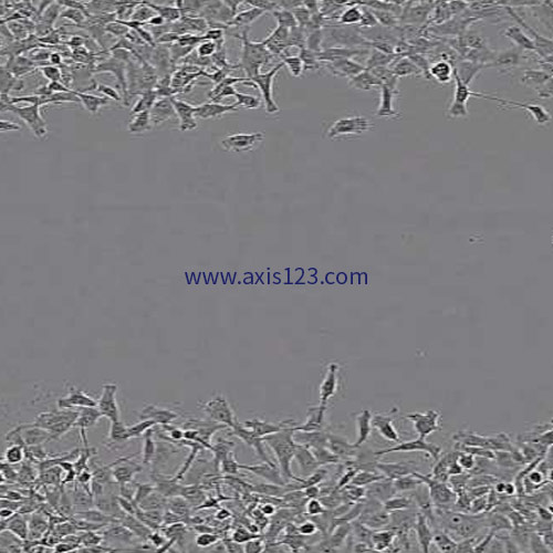 Cell Migration and Invasion
